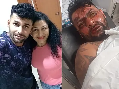 Ataque da ex-esposa cegou tatuador Leandro, confirma irmã (vídeo)