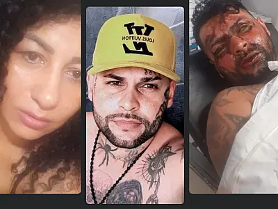 ​​Ex-esposa joga líquido corrosivo no rosto de tatuador campo-grandense